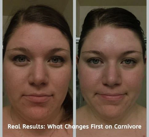 Real Results-What Changes First on Carnivore